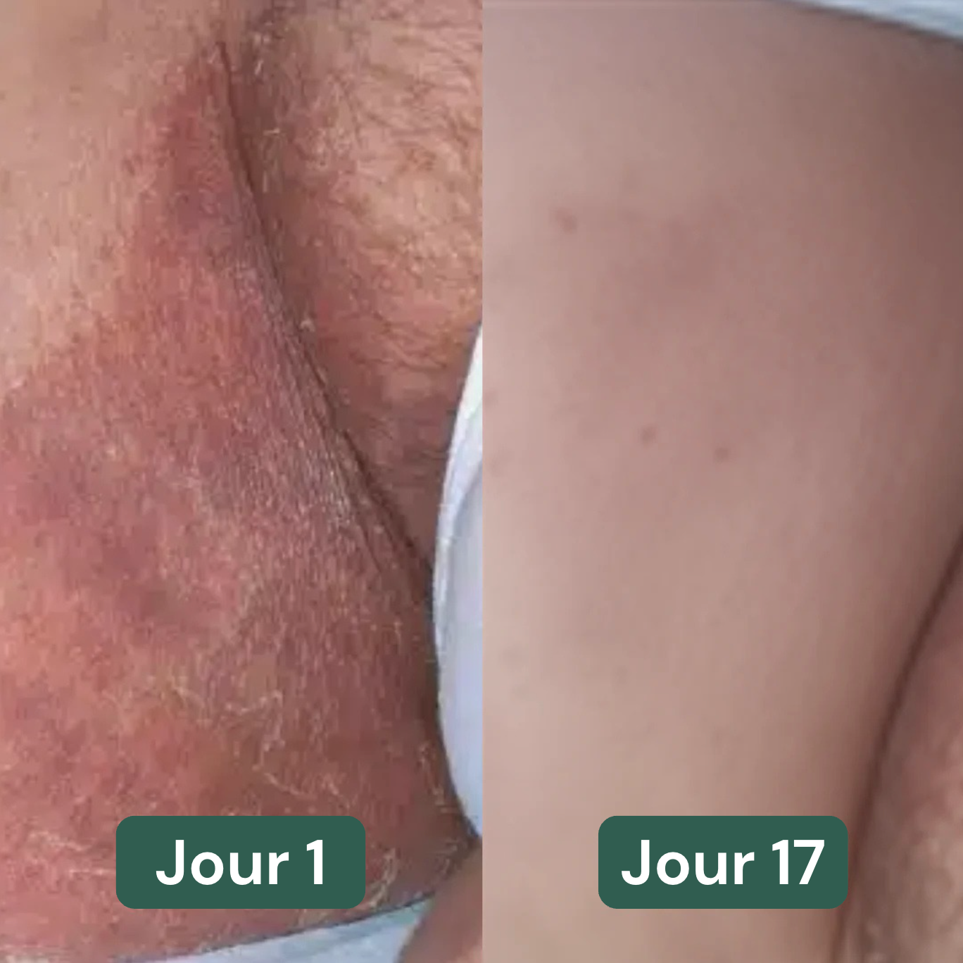 Ezenea | Soin lavant intime anti-inconfort