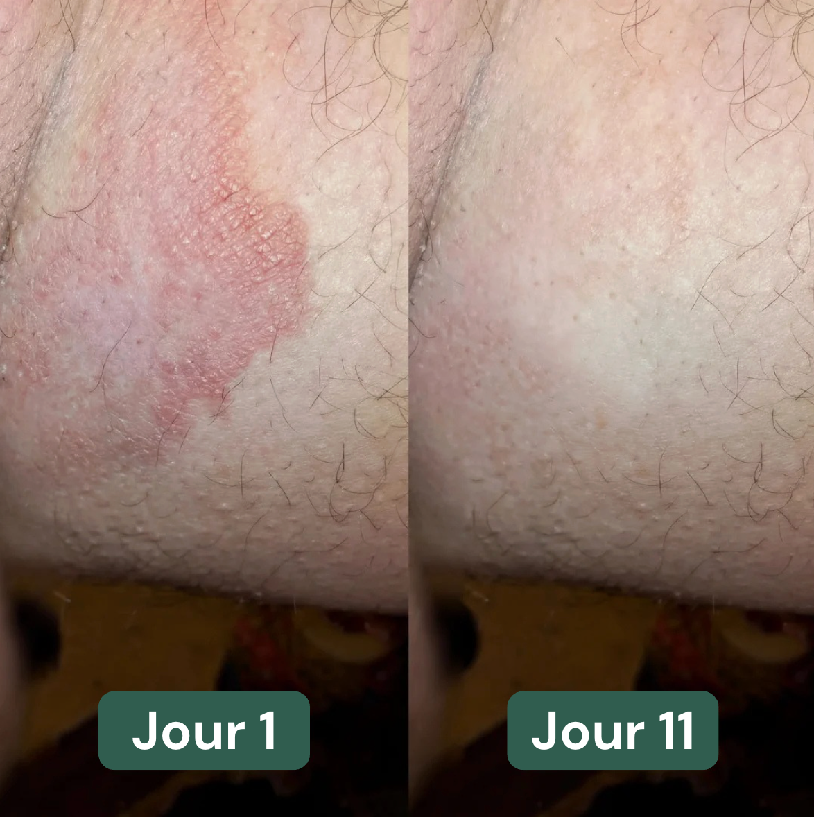 Ezenea | Soin lavant intime anti-inconfort