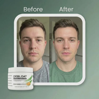 Ezenea® Balance — Face & Body Puffiness Support